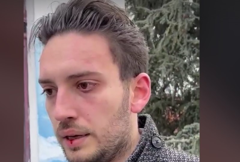 Grboviću razbijena glava: Napadnut lider Pokreta slobodnih građana VIDEO
