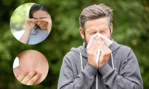 Poznati banjalučki alergolog otkriva: Tegobe sve izraženije, alergije uranile
