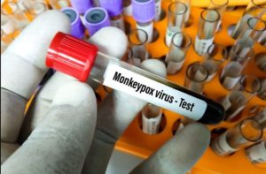 Razvijen PCR test za majmunske boginje