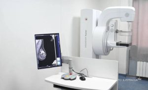 Dom zdravlja u Banjaluci dobio najsavremeniji digitalni mamograf