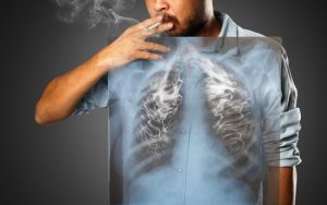 Pušači obratite pažnju na namirnice koje čiste pluća