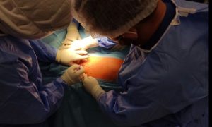 Uspjeh tima UKC-a Srpske: Ugrađuju vještački kuk operacijom koja garantuje bezbolniji oporavak