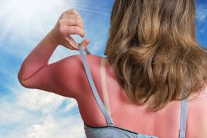 Korisni savjeti pred ljeto: Opekotine od sunca ublažite uz pomoć ova dva sastojka