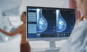 Olakšica za Banjalučanke: Efikasnije pružanje usluga skrining mamografije za članice “Iskre”