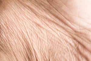 Stručnjaci otkrili: Četiri simptoma na koži znak da nemate dovoljno soli u organizmu