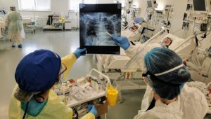 “Bijela pluća” znak bolesti: Rendgenski snimak ukazuje na ozbiljan zdravstveni problem