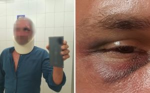 Brutalan napad na Korčuli: Beograđanina isprebijala četvorica muškaraca