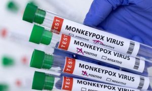 Pacijent u bolnici: U Crnoj Gori potvrđen drugi slučaj majmunskih boginja