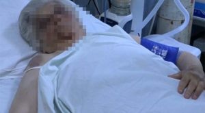 Prevezena u bolnicu: Ispovijest pretučene Srpkinje iz Sjeverne Mitrovice VIDEO