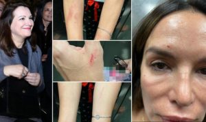 Severina završila iza rešetaka: Pjevačica uhapšena nakon tuče sa sestrom FOTO