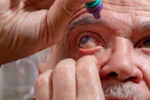 Osam simptoma pokazuje da li imate glaukom