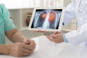 Revolucija u medicini: Zašto nepušači oboljevaju od raka pluća?