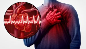 Kako prepoznati infarkt i spasiti život: Ovo su neki od znakova upozorenja