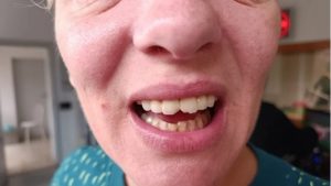 Nasilje u ordinaciji: Splićanki na gastroskopiji razbili zube