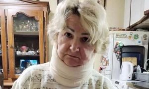 Žrtva brutalnog napada: Ovo je žena koju je pretukao muškarac na pijaci