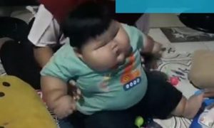 Star 16 mjeseci, a težak 28 kila: Ekstremno gojazni dječak čudo prirode