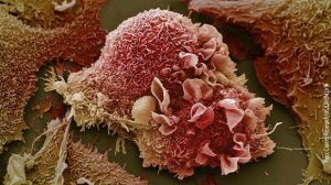 Naučnici došli do prelomnog otkrića u liječenju raka: Tajna se krije u DNK