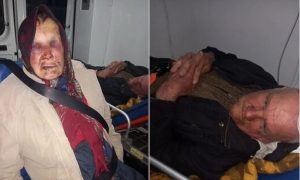 Zbrinuti u bolnici: Dvoje staraca brutalno pretučeni u svojoj kući