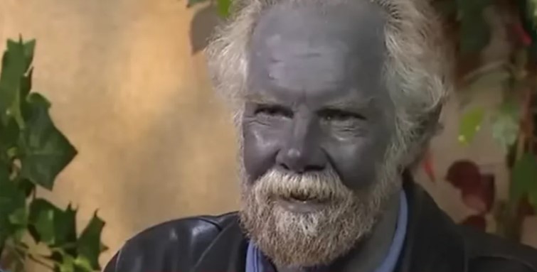 Do smrti su ga zvali Štrumf: Evo zašto je poplavio Pol Karason VIDEO