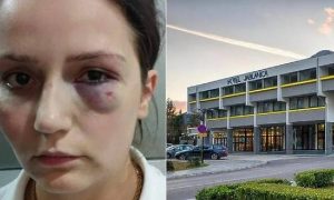 Radnica brutalno pretučena: Nasilni vlasnik hotela iz Jablanice priznao krivicu