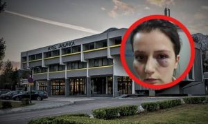 Dobila batine jer je tražila svoju platu: Pretučena radnica iz Jablanice najavila protest