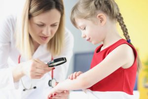 Psorijaza kod djece nije rijetka pojava – obratite pažnju na simptome