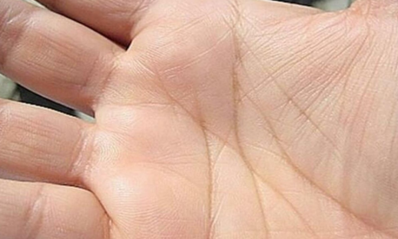 Mnogi vjeruju da je tu zapisana sudbina: Ljudi sa slovom M na dlanu nose poseban dar