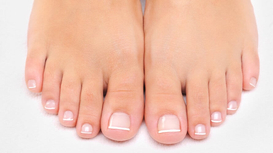 Rijedak slučaj: Tinejdžerka rođena bez noktiju na nogama VIDEO