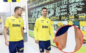 Fener objavio sliku Džeke i Krunića, navijači zgroženi: Šta mu je s koljenom?