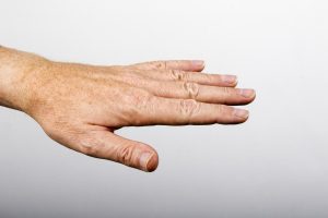 Tamna trijada: Dužina prstiju ukazuje na psihičke poremećaje