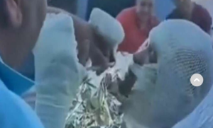 Hit snimak muškarca u zavojima i gipsu: Jedni plaču od smijeha, drugi se krste VIDEO