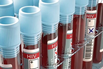 Napravljen mali pomak: Naučnici uspješno uklonili HIV iz zaraženih ćelija