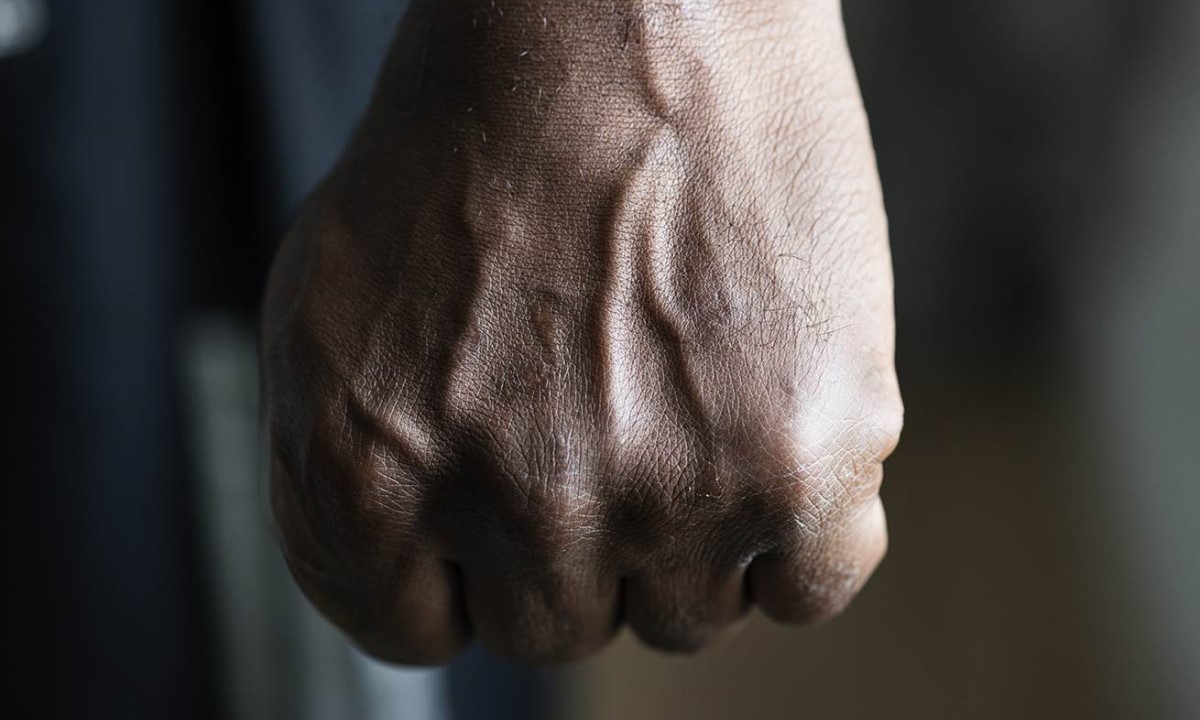 Posvađali se zbog parking mjesta: Mladiću smrskao kosti na licu
