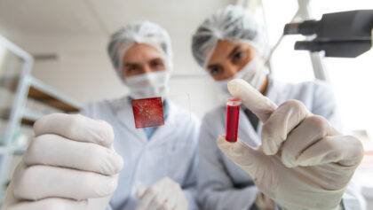Test krvi uz korišćenje vještačke inteligencije novi metod u dijagnostici sepse