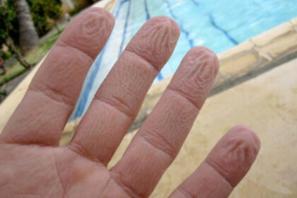 Neurolozi otkrili: Zašto se prsti smežuraju kada su dugo u vodi