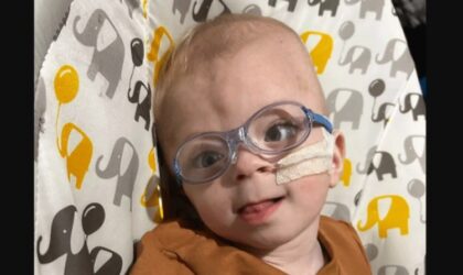 Mali heroj: Beba rođena bez malog mozga proslavila prvi rođendan