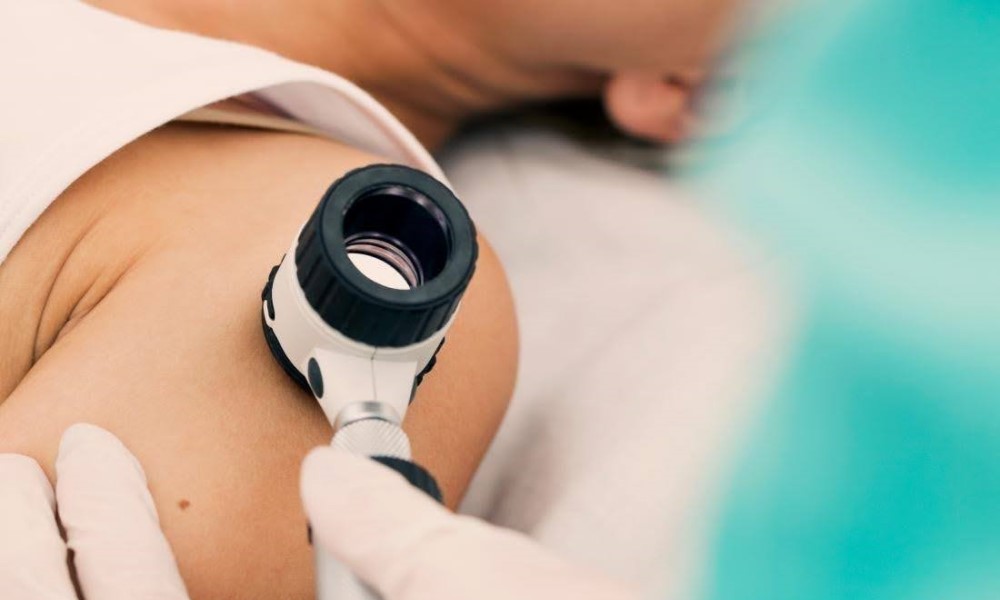 “Ključ” za spasavanje života: Besplatni preventivni pregledi kože u banjalučkom UKC-u