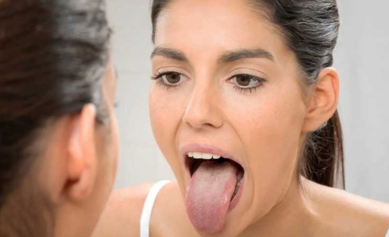 Obratite pažnju – radi sebe! Suva usta mogući znak ozbiljnih zdravstvenih stanja