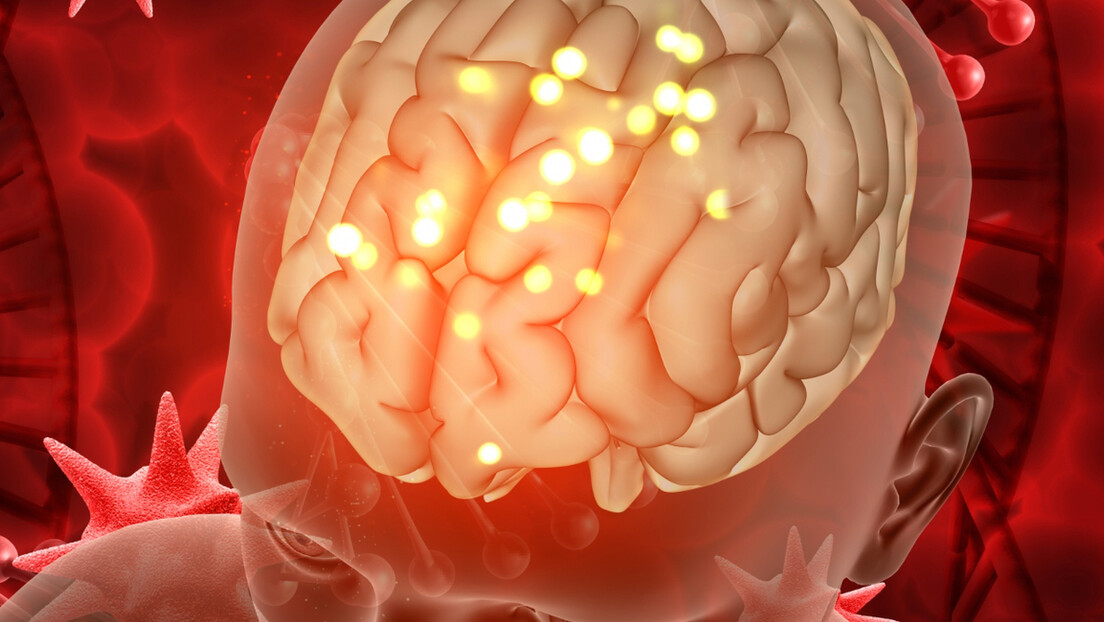 Prvi put u lobanju ugrađen aparat za suzbijanje epilepsije