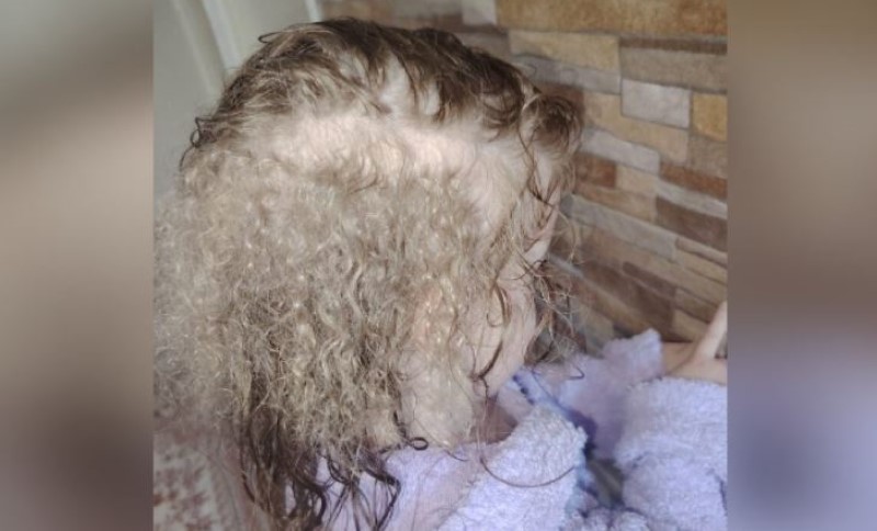 Roditelji zbunjeni, ali ni ljekari nemaju objašnjenje: Sofija ima tri godine i čak tri vrste kose