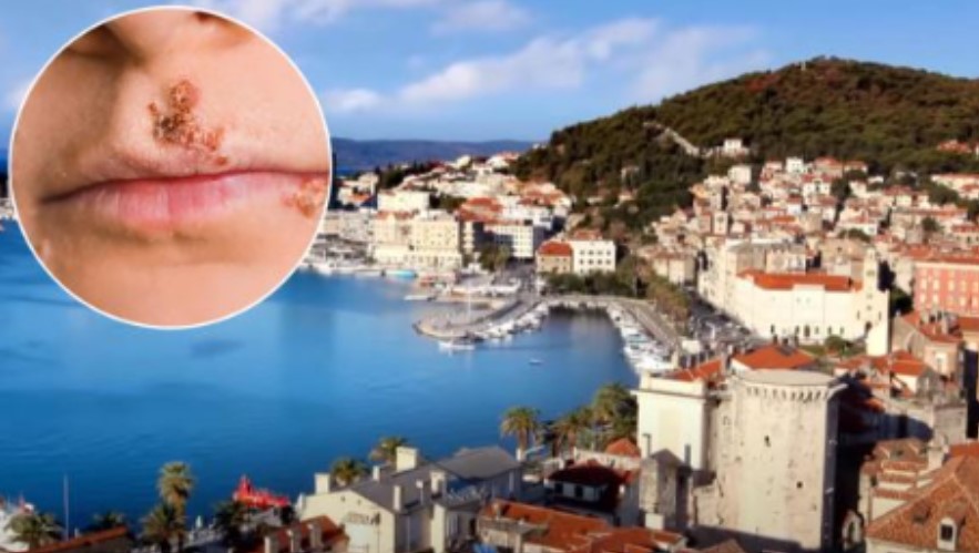 Čuvajte se zaraze! Na hrvatskim plažama se pojavile “slatke kraste”