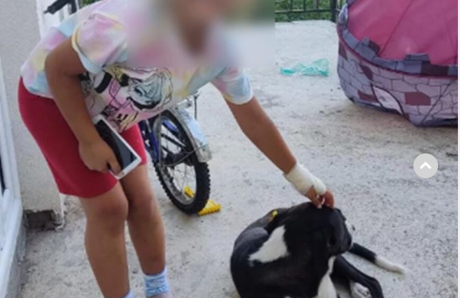Razdragana igra u dvorištu pretvorena u užas: Sedmogodišnju djevojčicu izujedao pas lutalica