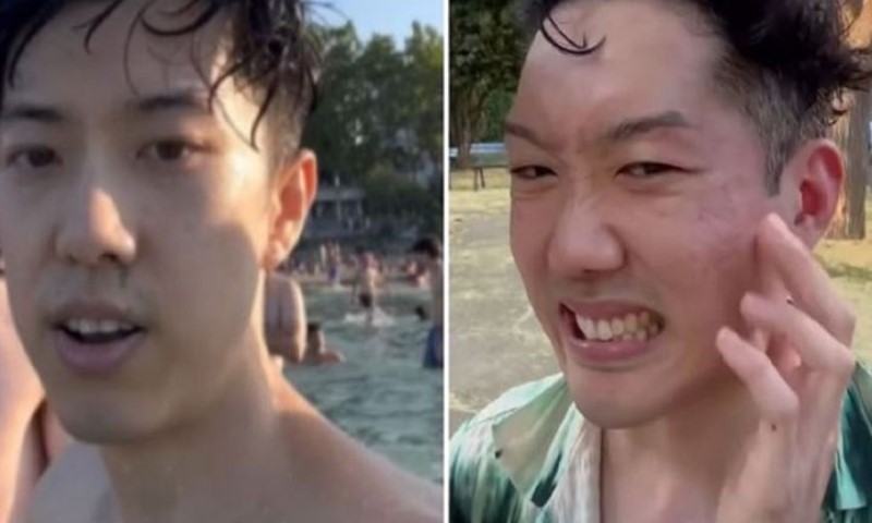 Tiktoker iz Londona optužio: Mene i momka su pratili u Splitu, udarali šakom, žena nas pljuvala