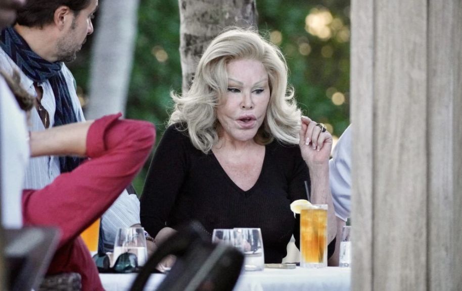 Bila je boginja ljepote, a onda se uništila operacijama: Njeno lice plaši ljude FOTO