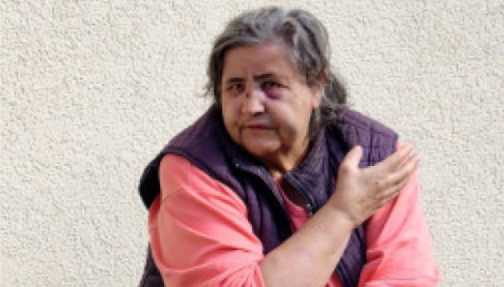 Oglasila se pretučena Dušanka: Napadač nas je šutirao i udarao palicom