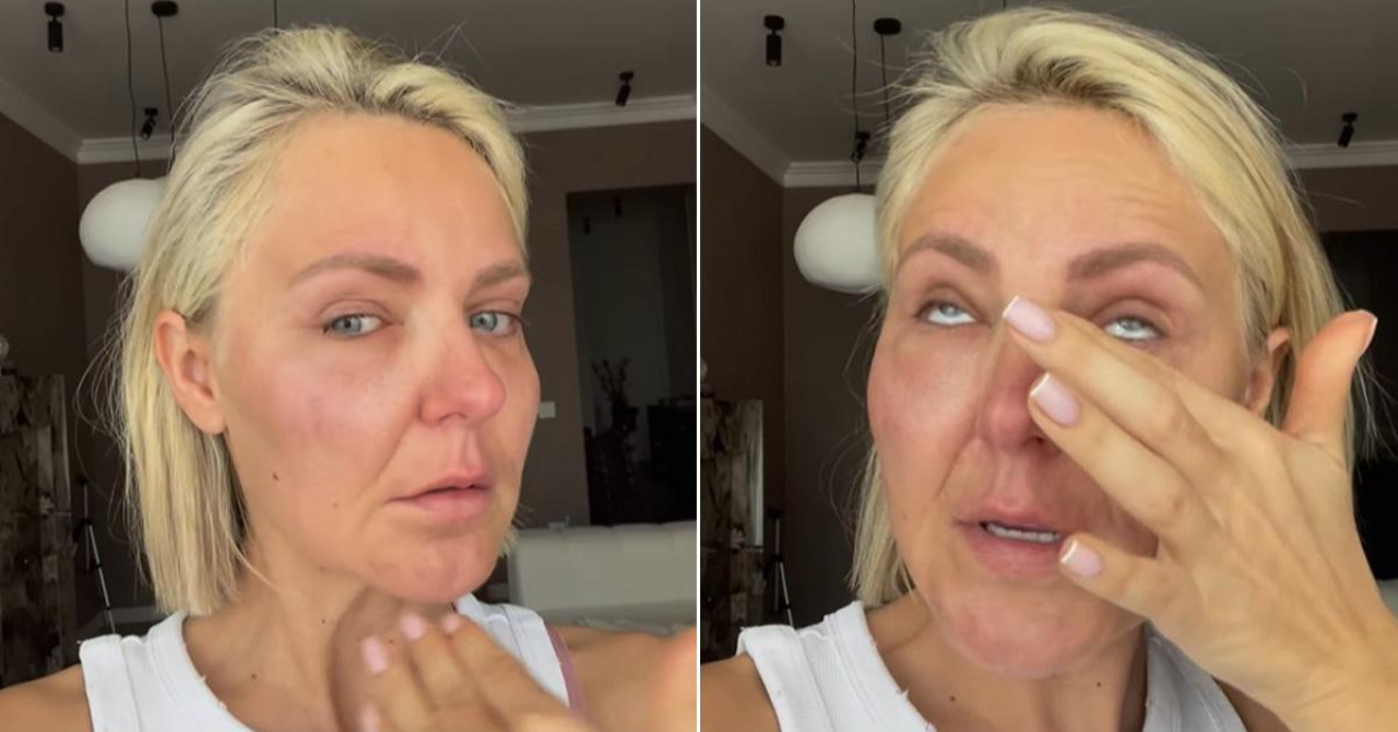 Banjalučanka Stankica šokirala javnost: Zbog sumnjivog filera prolazim agoniju VIDEO