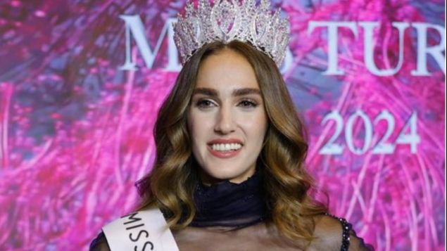 Mis Turske optužuju da je titulu dobila preko veze: ”Nije dovoljno lijepa” FOTO