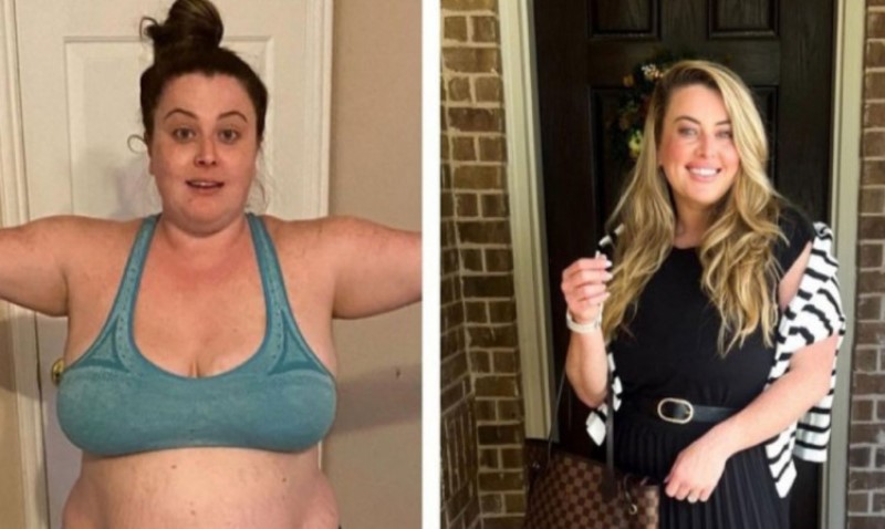 Zvali je “nasukani kit”: Žena nakon brutalnih uvreda smršala više od 60 kilograma