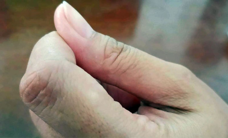 Veoma zabavno, probajte: Palac lijeve ruke može otkriti nešto važno o nama VIDEO