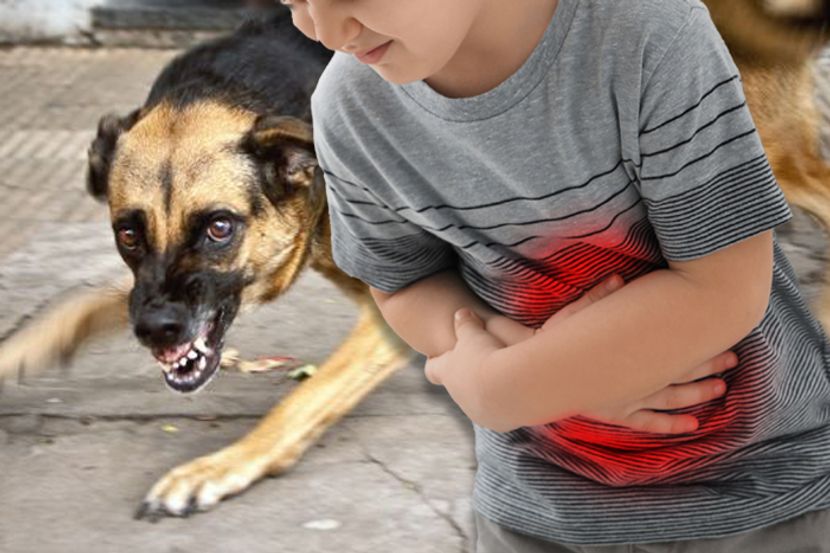 Slijedite ove korake: Šta uraditi ako vas napadne pas?